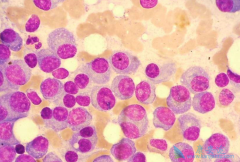 �෢����������ΪʲôҪ������ֲ��