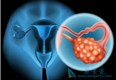 �����������׸���������BRCAͻ���ѳ�������һ��ά�����Ƶ�PARP���Ƽ�