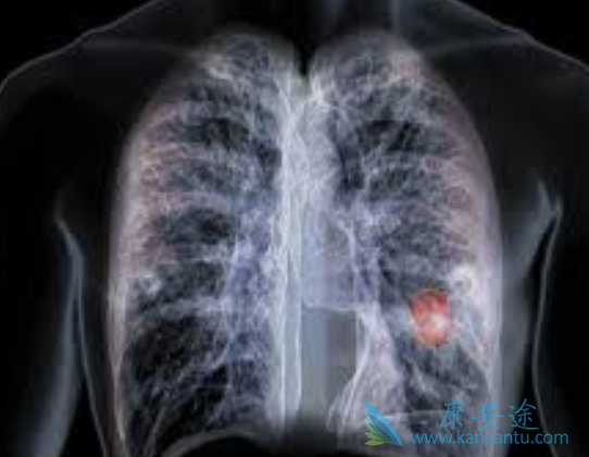 ���ڷ�Сϸ���ΰ�