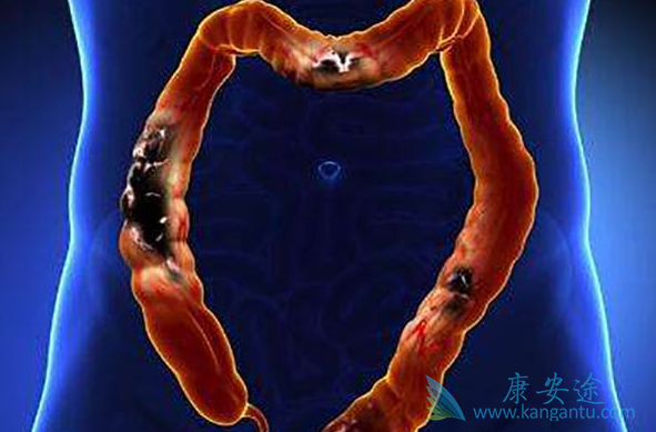 ��ֱ����