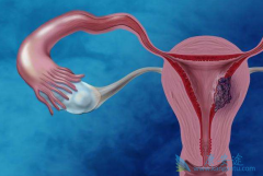 �����ӹ�����ԭ������Щ�����Ԥ����֢��