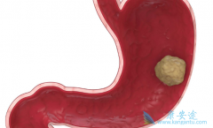 ��Ĥת��������θ�����ߵ���Ҫ����ԭ��֮һ