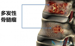 �������Զ෢�Թ��������ߵĴ������