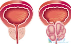 ǰ���ٰ����Ƶĺ�������Щ����ҩ����ã�