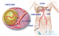 ����������˨���Ʒ����Ƹ�ϸ�������ߵ�Ч����ô����