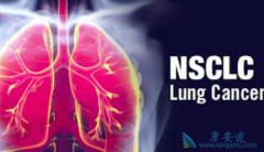 Сϸ���ΰ�����Ŀǰ�����Ƽ���Щҩ�