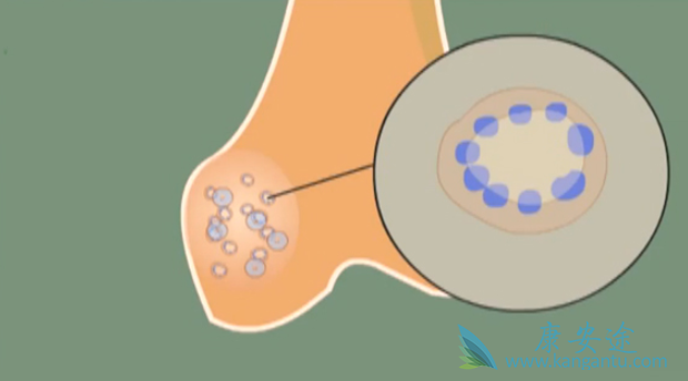 双磷酸盐 双磷酸盐