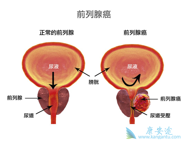 多西他赛 多西他赛