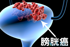 ���װ��Ĳ�����ճ���Ӧ���ĵİ��װ�֢״