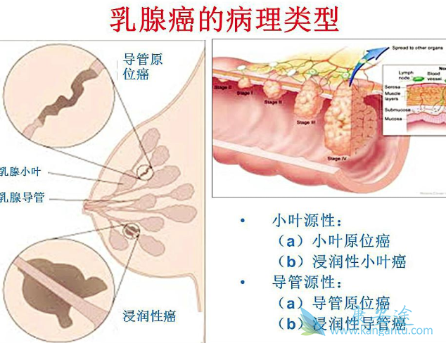 ���������ٰ�