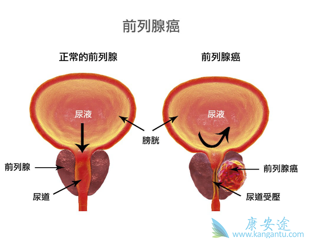 ǰ���ٰ��ܻ���