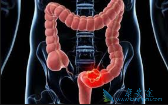 ��ֱ����