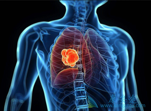 �ΰ���������