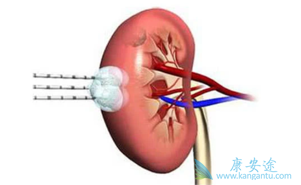 ����������֢״