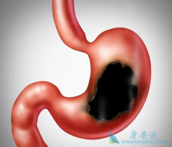 ����θ��