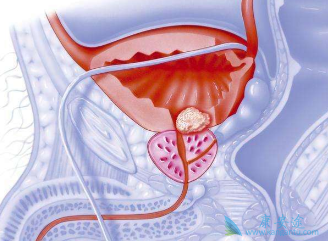 ǰ���ٰ���Ԥ��