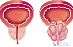 ǰ���ٳ�����Щ֢״ʱ��ʾ���ܵ���ǰ���ٰ�֢