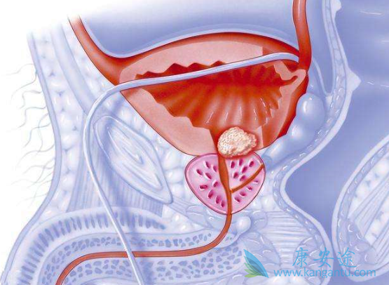 ǰ���ٰ�������