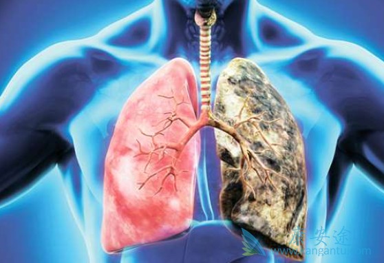 �ΰ����Ƹ�����