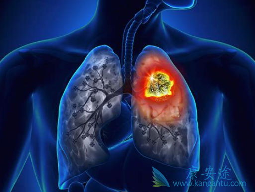 �ΰ�������