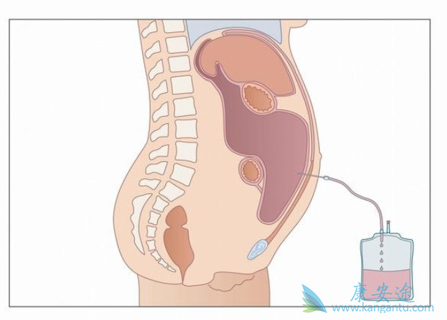 �θ�ˮ����֢״