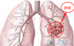 �ΰ����ڵ�֢״����Щ��