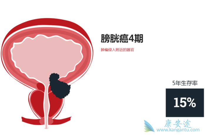 ���װ�����