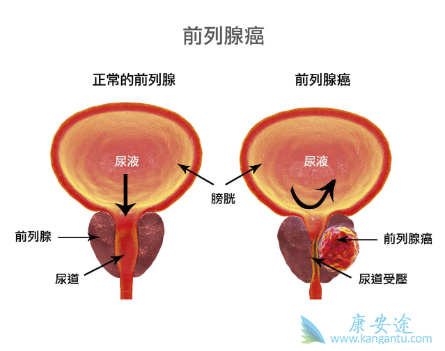 ǰ���ٰ�����