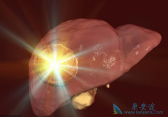 �ط�����������ƶ�Child-PughB/C������ռλ��50%�����ڸΰ�������Ч