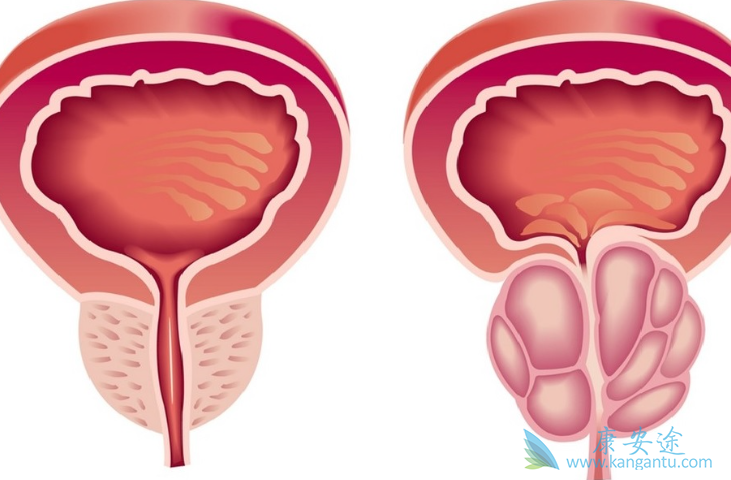 ǰ���ٰ�����