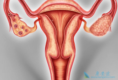 ������������Ϊbrca�ѳ���һ��ά���Ʒ�