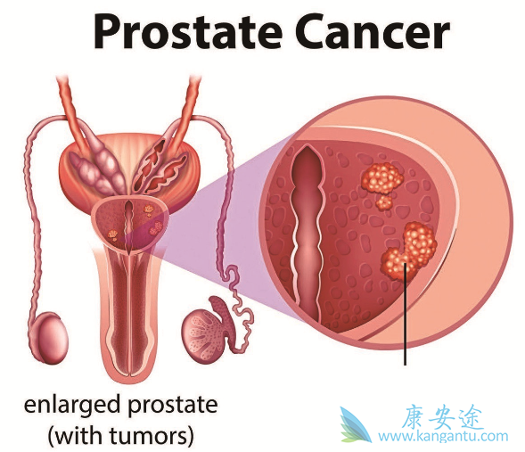 ǰ���ٰ�������