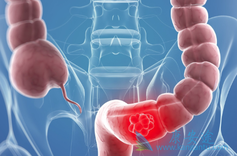 ��ֱ��������