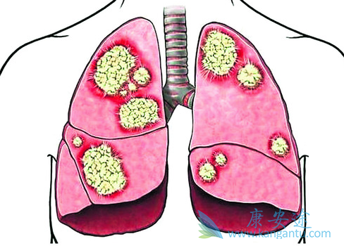 �ΰ������ֶ�