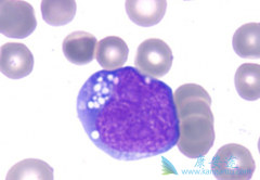 ʲô�ǲ������ܰ���