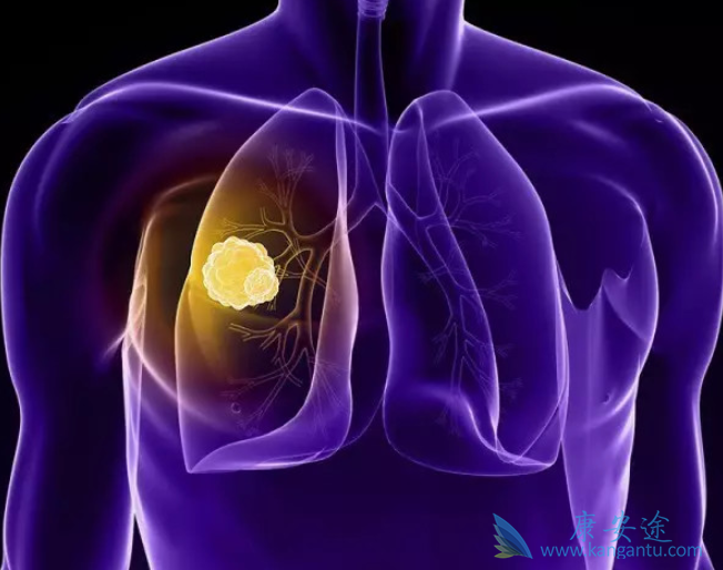 �ΰ������ܻ���