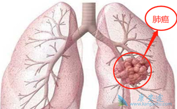 ʲô�Ƿ�Сϸ���ΰ�