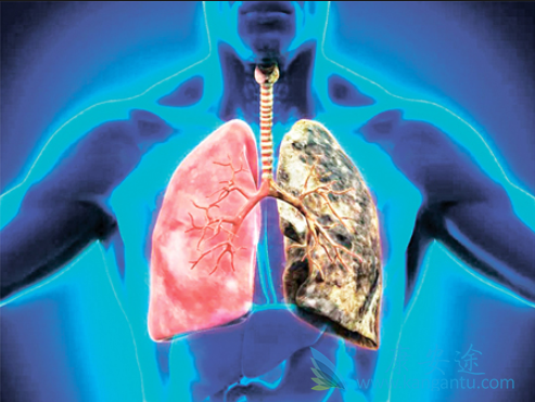 Ԥ���ΰ�����