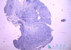 �ͷֻ��ٰ����ڸ���ô���ƣ�