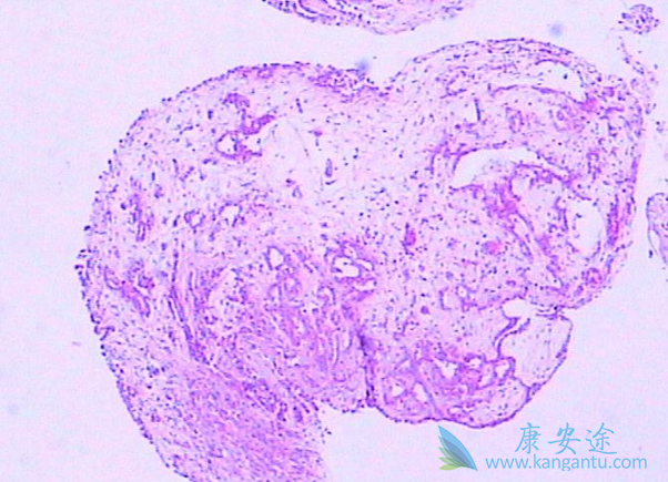 ʯ����ʲô��