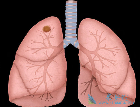 �ΰ����ڻ���