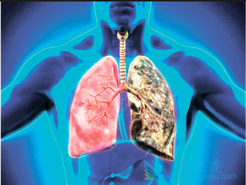 Ԥ���ΰ�����