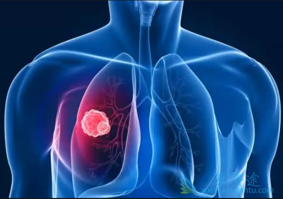 �ΰ�������ô����