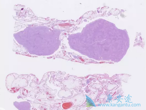 ��Ƥ�����κ���