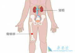 ������ת����δ�����