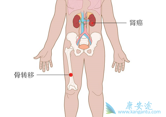 ������ת��