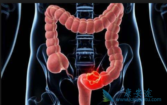 ��ֱ����