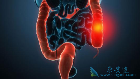 ��ֱ����