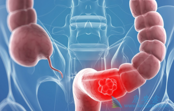 ��ֱ��������