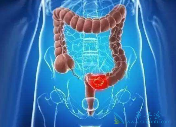 ��ֱ����